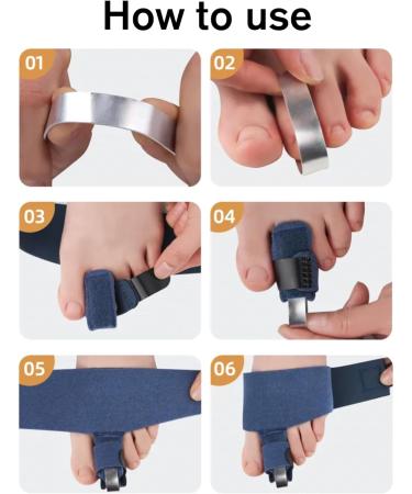 Sovio U Shaped Toe Straightener for Bent Toes + Hammer Toe Support (1PC) + Toe Separators (2PC) - Toe Straighteners for Broken Toes - Buy Online on GoSupps.com