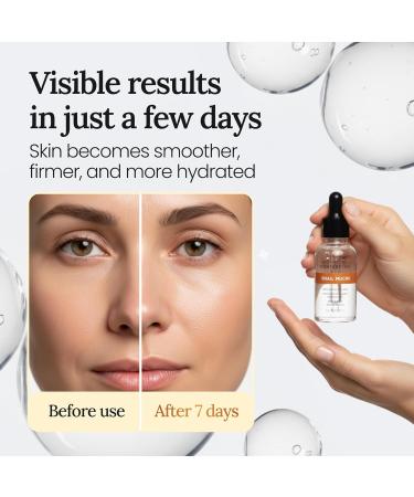 Context Skin Snail Mucin Serum for Face - Lightweight Hydrating Facial Serum with Snail Extract - Fast-Absorbing Formula for Smooth-Feeling Skin and Natural Glow -1 Fl Oz - Buy Online on GoSupps.com