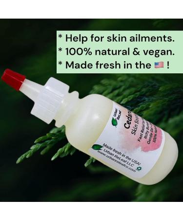 Urban ReLeaf Cedarwood Skin Soothing Gel - Fast Relief for Irritated Skin, Itchy Bumps, and Rash | 100% Natural Thuja Remedy - Buy Online on GoSupps.com