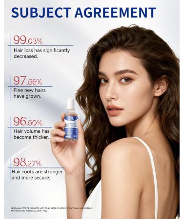S rum de croissance des cheveux roll-on 50 ml | 3 % d'extrait de romarin + caf ine + niacinamide + biotine | Avec gingembre et aloe vera | Ne pas rincer p n tre rapidement | Pour cheveux clairsem s - Buy Online on GoSupps.com