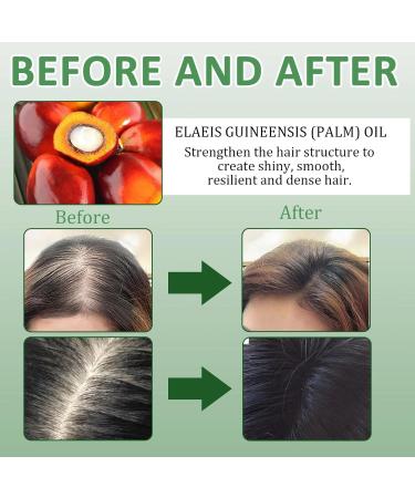 Batana Oil for Hair Growth Botana Oil Botana Hair Growth Oil Raw Batana Oil Organic Batana Oil Botana Oil Organic Promote Hair Growth Repair Damaged Hair Suitable for Men and Women (100ml) - Buy Online on GoSupps.com