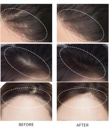 Instantly Hairline Powder Instantly Hairline Shadow Hairline Powder Hairline Shadow Powder Hairline Powder Hair Shadow Powder For Women And Men Thinning Hair Eyebrows Beard Line (Black) - Buy Online on GoSupps.com
