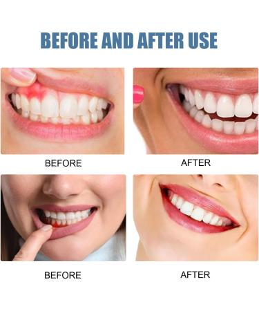 Koahde Tooth & Gum Care Spray - Toothache Relief Gum Repair & Regrowth Solution - 1pc - Buy Online on GoSupps.com