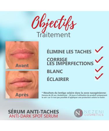  NE NEZENI Effective anti-stain depigmenting serum | 13 active ingredients: 10% Niacinamide + 2% Arbutin + Vit-C + 3 powerful new active ingredients. Nezeni Generation - Low Preservatives 2 Years Closed Shelf - Buy Online on GoSupps.com