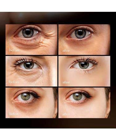 3Pcs SADOER Retinol & Caffeine Moisturizing Anti-Wrinkle Cream SADOER Eye Cream Caffeine Anti-Wrinkle Eye Cream for Bags Puffiness - Buy Online on GoSupps.com