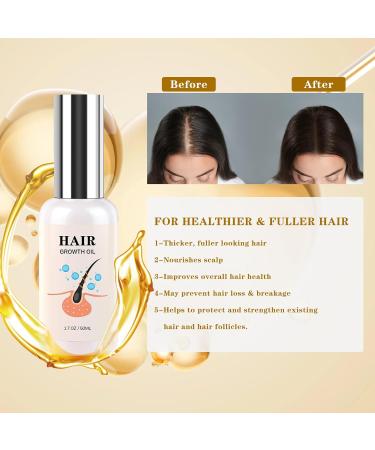 Hair Growth Serum - Rice Water for Thicker Fuller Hair | Biotin Castor & Rosemary Oils for Men & Women - 50ml - Buy Online on GoSupps.com