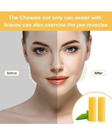 Skhaovs 16-Piece Aligner Chewies - Essential Tablets for Comfortable Aligner Wear | International Shipping Available - Buy Online on GoSupps.com