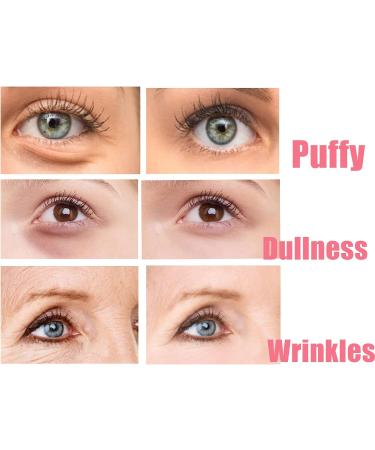 Brighten Eye Cream Stick Rosehip Moisturizing Balm Stick Hydrating Moisturizing Stick Eye Cream for Dark Circles And Puffy Eyes & Wrinkles Multi Eye Balm Wrinkles Lift Eye Line & Anti-Aging (1) - Buy Online on GoSupps.com