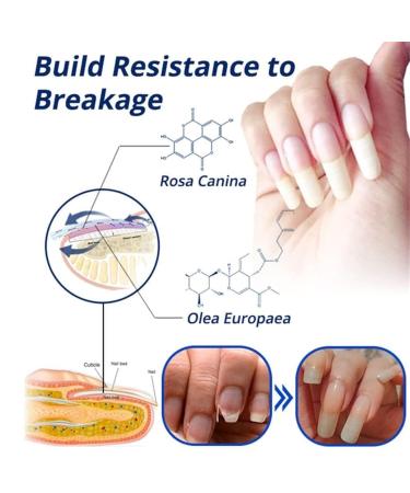 7 Days Nail Recovery Growth Essence Pen - Strengthening Serum for Thin Nails | Fast Nail Repair Solution - 1 PC - Buy Online on GoSupps.com