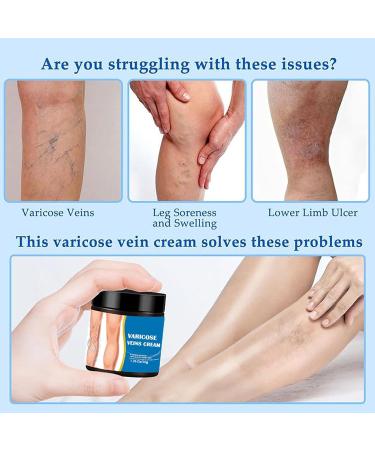 Leg Cream - Muscle Warming Cream | Foot Detox | Slow-Relieving Natural Lotion 50g | Reduces Swollen Calves for Women Ideal for Teachers - Buy Online on GoSupps.com