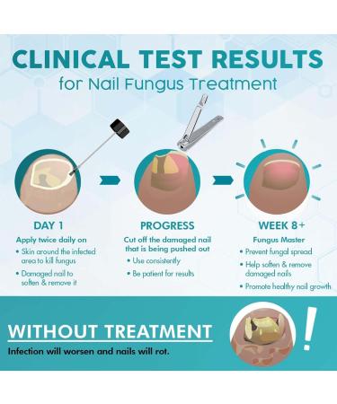 Toenail Fungus Treatment - Nail Fungus Treatment for Toenail - Anti Fungal Nail Treatment for Thickening Yellow - Brown Discoloration - Fast Extra Strong Nail Repair Solution - Buy Online on GoSupps.com