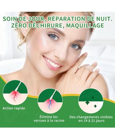 Action Rapide Anti Verrue pour Verrue Plantaire Verrue Commune Verrue Plate Soin Verrues Pieds & Mains limination Doux des Verrues Plantaires Action Rapide 15 ml 15 ml (Lot de 1) - Buy Online on GoSupps.com