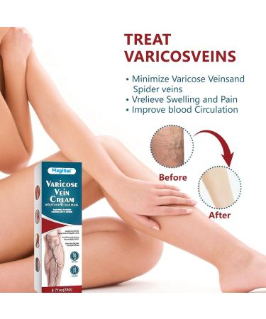  MagiSel Varicose Vein Cream Spider Leg Repair Cream Vein Soothing Cream Relieves Tired and Heavy Legs Soothes and Moisturizes 20g - Buy Online on GoSupps.com