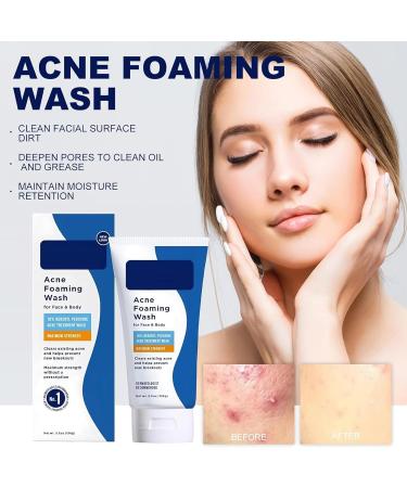 Mousse nettoyante pour l'acn Lotion Nettoyante Visage Et Corps Acne Clean Foam Cleanser Mousse nettoyante Nettoyant pour le Visage Doux pour le Nettoyage des Pores Profonds - Buy Online on GoSupps.com