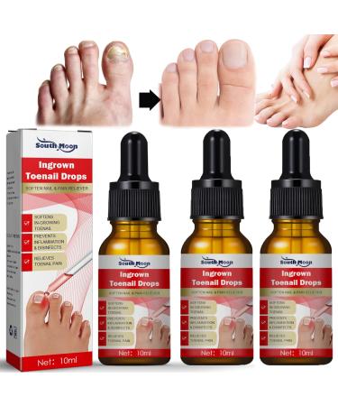 Ingrowth Toenail Correction Treatment Oil Ingrown Toenail Treatment Kit Correction Ingrown Toenail Drops Cuticle Nail Oil Nail Fungal Treatment for Ingrown Toenail(3pcs 10ml)