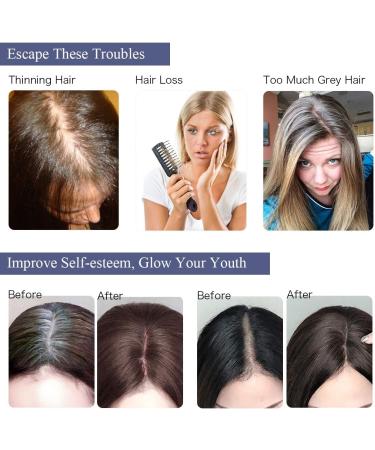 Yamel Hair Toppers for Women - Black Straight Synthetic Wiglets with 2 Clips - Hairpieces for Thinning Hair - Buy Online on GoSupps.com