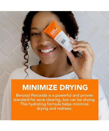 University Medical Acne Wipeout All Day Breakout Control Hydrating Acne Cream - Time Released All Day Clearing Micronized 2.5% Benzoyl Peroxide Treatment Hydrating Minimal Dryness 2 fl oz - Buy Online on GoSupps.com