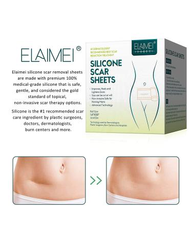 Reusable Silicone Scar Sheets | Softens & Repairs Scars | for Injuries, Burns, Acne, C-Section, Stretch Marks | Washable | 1.6 x 120 - Buy Online on GoSupps.com