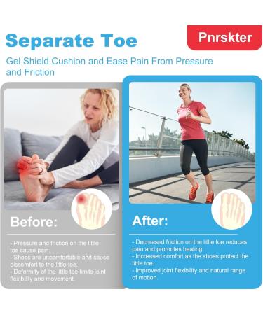Big Toe Protectors (10PCS) - Breathable Gel Toe Sleeves for Corns Calluses & Hammer Toe - Aloe Vera Infused Comfort - Buy Online on GoSupps.com