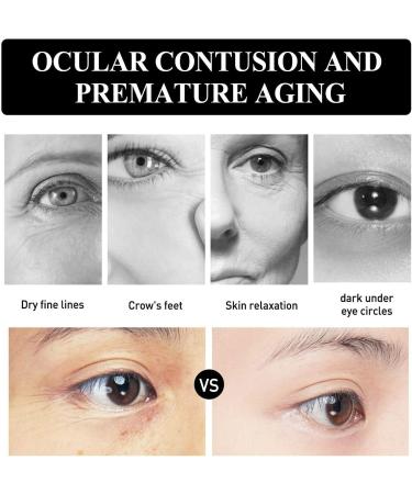 Instant Caffeine Eye Cream Caffeine Eye Serum for Under Eye Bags Polypeptide Eye Cream for Anti Aging & Anti Wrinkle Raffermissante Instantan e pour les Yeux hydratation en profondeur (30ml 3pc) 3pc 30 ml (Lot de 1) - Buy Online on GoSupps.com