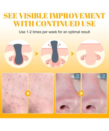 Nose Strips 80 Packs Blackhead Remover Pore Strips Blackhead Pore Strip Deep Cleansing Nose Strips for Clearer Skin White - Buy Online on GoSupps.com