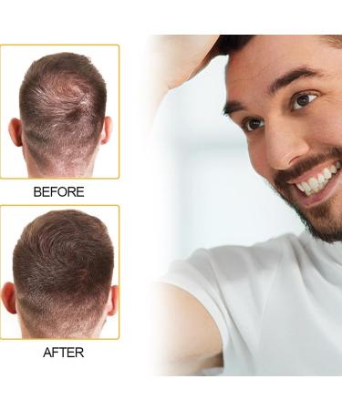 Correcteur capillaire volumateur naturel invisible et naturel pour des cheveux plus s rs convient aux hommes et aux femmes. - Buy Online on GoSupps.com