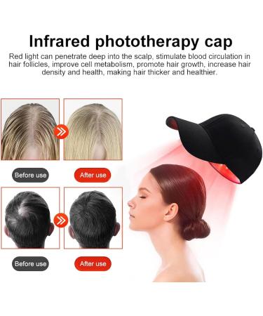 Hair Growth Treatment Hat Red Light Therapy Hair Growth Cap Dual Wavelength 630nm & 650nm for Hair Regrowth - Buy Online on GoSupps.com