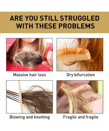 Biotin Shampoo Biotin Shampoo With Volumising Castor Oil Rosemary Oil And Keratin Biotin Shampoo For Dry And Damaged Hair Hair Thickening Treatment For Women & Men With Progressed Thinning - Buy Online on GoSupps.com