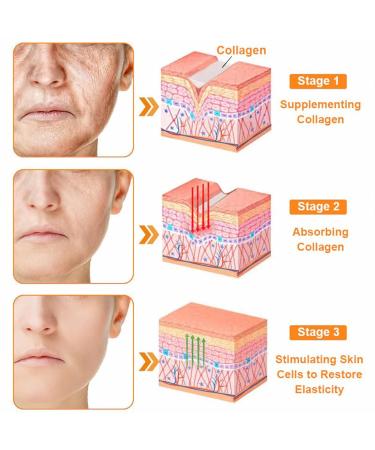 Luhaka PUROSA Bee Venom Treatment Cream Bee Venom skin Restoration Cream Lift and tighten the skin improve wrinkles and fine lines(1PC) - Buy Online on GoSupps.com