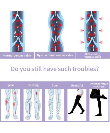 Thigh High Compression Stockings 20-30 mmHg - Closed Toe Socks for Women & Men | Black XX-Large - International Shipping Available - Buy Online on GoSupps.com