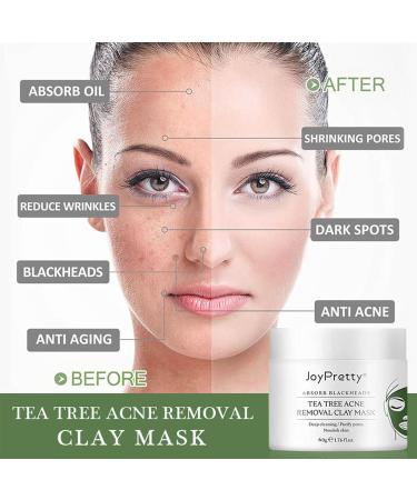 Tea Tree Facial Mask - Deep Cleansing Pore Purifying Clay Mask for All Skin Types Blackheads & Acne Treatment - Buy Online on GoSupps.com
