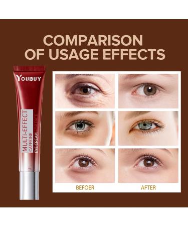 mercham Caffeine Eye Cream Under Eye Cream for Dark Circles Puffy Eyes Reduce Fine Lines Brightening & Moisturizing Eye Serum Creams Anti-Aging Eye Repair Cream for Men and Women - Buy Online on GoSupps.com