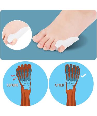Pinky Toe Separator Gel Bunionette Protector - 6 PCS Tailors Bunion Little Toe Cushions for Pain Relief and Corn Callus Blisters - Buy Online on GoSupps.com