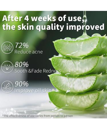 NAILKISS Aloe Vera Gel Organic Moisturizing Cream Soothing and Hydrating for Face Skin Hair & Sunburn Relief 100% Pure Aloe Gel for All Skin Types-300ml (10.1fl.oz) - Buy Online on GoSupps.com