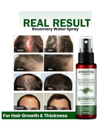 Rosemary Water for Hair Growth Spray - 100% Natural Hydrosol with Peppermint Oil & Caffeine for Stronger Thicker Hair | International Shipping Available - Buy Online on GoSupps.com