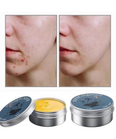 Norse Organics Acne Clearing Cream (2pcs) - Skin Nourishing Formula for Teens & Adults Redness Relief Repairs & Smooths Skin - Ideal for Men - Buy Online on GoSupps.com
