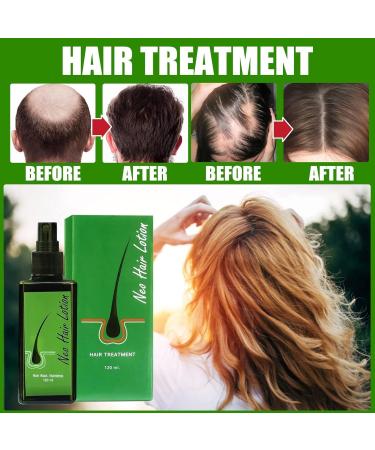  Huien Huien Hair Growth Serum for Men and Women 120 ml Hair Regrowth Lotion and Hair Growth Care DHT Blocker - Buy Online on GoSupps.com