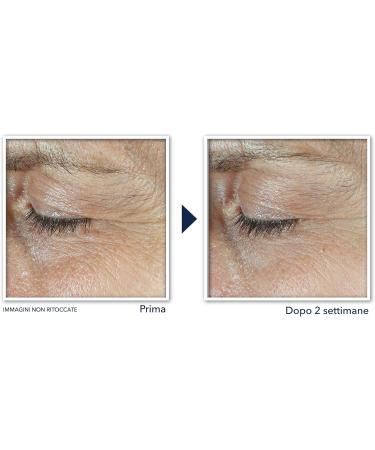 RoC Derm Correxion Dual Eye Cream with Advanced Retinol + Peptides for Puffy Eyes and Dark Circles 2 x 10mL - Buy Online on GoSupps.com
