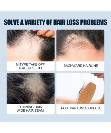 Extra Strength Hair Regrowth for Men's Hair Loss Men's Hair Growth Serum for Beard Care Serum - Buy Online on GoSupps.com