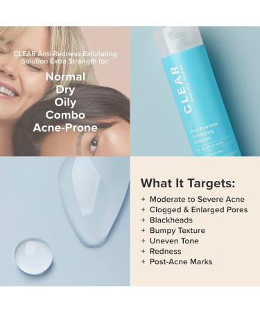 Paula's Choice CLEAR Extra Strength 2% Salicylic Acid Exfoliator 4 oz - Acne & Redness Relief - Buy Online on GoSupps.com