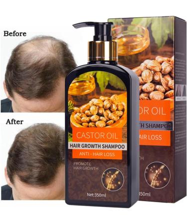 Hocossy Castor Oil Hair Growth Shampoo - Volumizing Shampoo for Hair Loss Thin Hair Shampoo for Men & Women Natural Ingredients 350m Castor Oil Shampoo - Buy Online on GoSupps.com