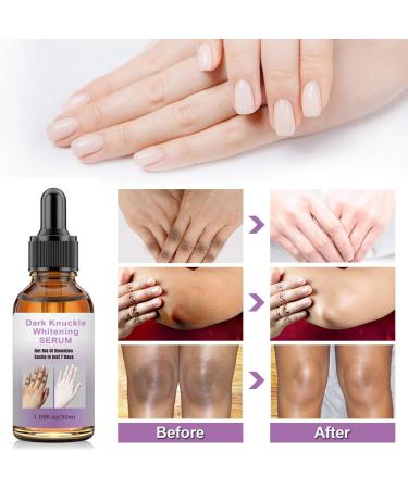 Dark Knuckle Whitening Serum Whitening Cream Knee Whitening Serum Joint Whitening Essential Oil Joint Brightening Cream Skin Lightening Serum for Und r rms Elbows Knees - Buy Online on GoSupps.com