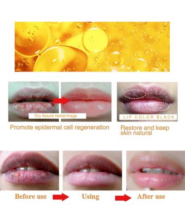 Ginger Lip Lightening for Dark Lips Lips Pink Bleaching Cream Balm Lip Balm Fast Moisturizing Lightening Lip Balm Brightening Cream Blam Lip Care Lightens Remove Dark Lips Lip Pigmentation Treatment - Buy Online on GoSupps.com