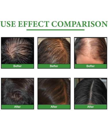 Fufu Girls Jamaican Black Castor Oil Organic Castor Oil 100% Pure Cold Pressed Black Castor Oil Essential Oils for Body Face & Skin Moisture Nails & Eyelashes 2pc - Buy Online on GoSupps.com