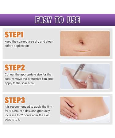 Silicone Scar Sheets & Tape | Effective Scar Removal for Surgical & Keloid Scars - 1.6 x 59 Roll (1.5M) - Fast International Shipping - Buy Online on GoSupps.com