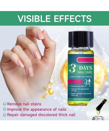 Huile Cuticules Ongles Huile De Soin Pour Les Ongles 3 Jours Vernis Durcisseur Ongle Keratine Fortifiant Ongle Prot Ine De K ratine Hydrate Et Renforce Les Soins limine Fissur s (2PC) - Buy Online on GoSupps.com
