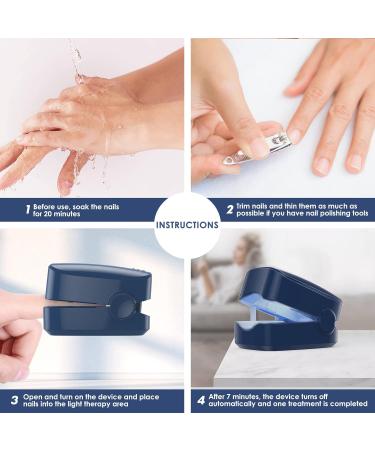 Rechargeable Nail Fungus Laser: Home Use LED Light Treatment - SUNCKY - Buy Online on GoSupps.com