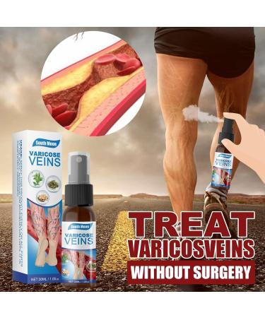 2pcs Veinhealing Varicose Veins Treatment Spray Veinhealing Varicose Veins Spray Vein Healing Varicose Veins Treatment Spray for Legs Varicose Veins Miracle Spray (30ml) - Buy Online on GoSupps.com