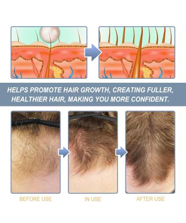 Hoegoa Alpha Grow Nourishing Hair Scrub Scalp Treatment for Hair Growth and Strengthening 3.53oz - Buy Online on GoSupps.com