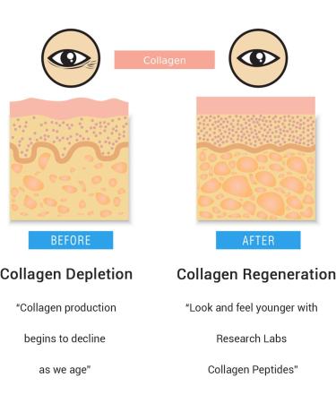 Research Labs 2 for 1 Promo 240 Collagen Pills - 6000 mg Per Day. Grass Fed Anti-Aging Support for Skin, Joints, Tendons, Bones, Hair and Nails. Paleo Friendly. Collagen Peptides Powder Supplement  - Buy Online on GoSupps.com